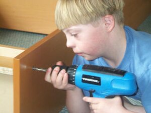 Down syndrome